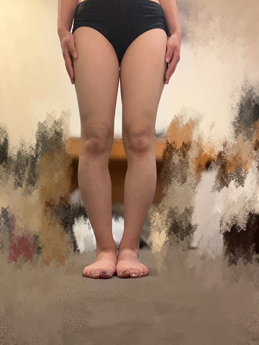 wtrj_'s tweet image. ダイエット2日目！！
⭐️筋トレ内容→昨日と同じやつ

変わったことと言えば、黒酢や納豆のようなダイエットに良さそうな食べ物を買ったこと😮‍💨

あと暫く米禁止します🤬

#ダイエット一緒に頑張ってくれる人RT 
#ダイエット垢 
#ダイエットのモチベーション 
#ダイエット仲間募集中 
#ダイエット記録