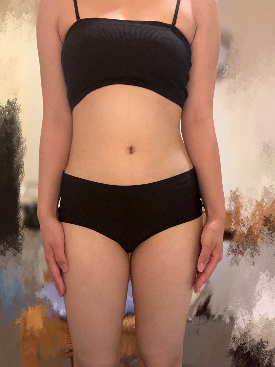 wtrj_'s tweet image. ダイエット2日目！！
⭐️筋トレ内容→昨日と同じやつ

変わったことと言えば、黒酢や納豆のようなダイエットに良さそうな食べ物を買ったこと😮‍💨

あと暫く米禁止します🤬

#ダイエット一緒に頑張ってくれる人RT 
#ダイエット垢 
#ダイエットのモチベーション 
#ダイエット仲間募集中 
#ダイエット記録