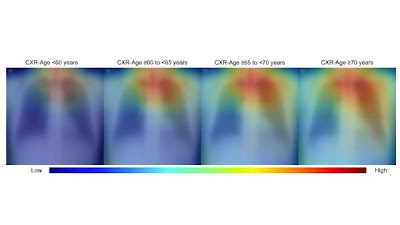 Radiology: Artificial Intelligence (@radiology_ai) on Twitter photo Assessing the prognostic value of CXR-Age model in a large test cohort doi.org/10.1148/ryai.2⦠<a href="/SNU_Rad/">SNU Radiology</a> #Aging #mortality #AI Assessing the prognostic value of CXR-Age model in a large test cohort doi.org/10.1148/ryai.2⦠<a href="/SNU_Rad/">SNU Radiology</a> #Aging #mortality #AI