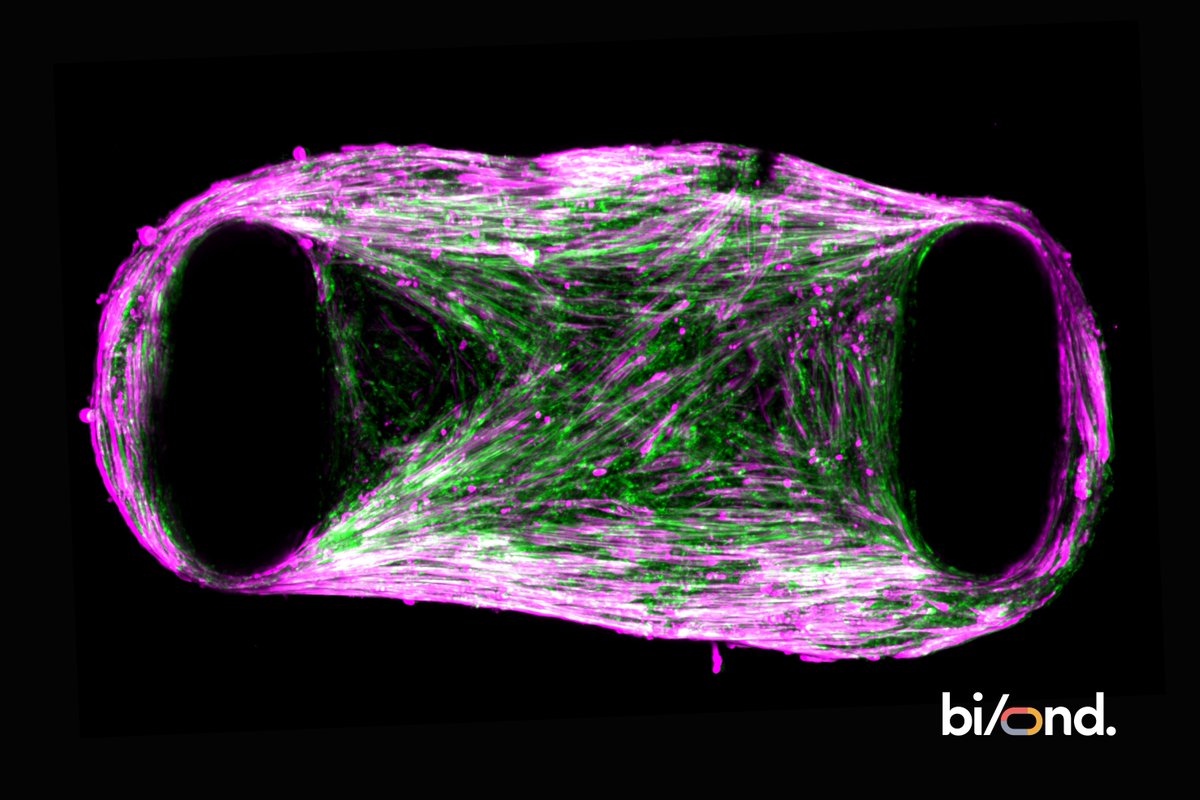 Download this poster to discover how Bi/ond successfully created 3D skeletal muscle microtissues within our MUSbit™ OoC platform, which exhibited robust twitch and tetanus contraction profiles that strengthened over time. 
shorturl.at/9CFMf 
Cells: <a href="/bitbio/">bit.bio</a>