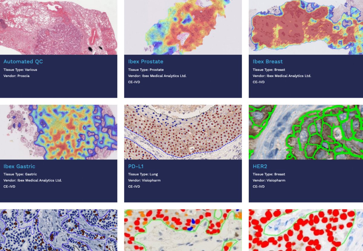 Proscia's tweet image. We've made it easier for you to learn about our precision medicine AI portfolio!

See our new site page for the diagnostic and research applications available on Concentriq and in our pipeline from Proscia and our partners @IbexMedAx, @Visiopharm, DoMore Diagnostics, @stratipath,…