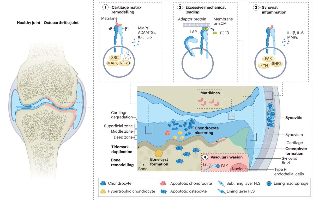 #AugustIssue | #Integrins are involved in joint tissue development and homeostasis, and perturbations in the availability of integrin ligands or in downstream integrin signalling are linked to the pathogenesis of #osteoarthritis

Read more in this #Review

dlvr.it/T9gwRg