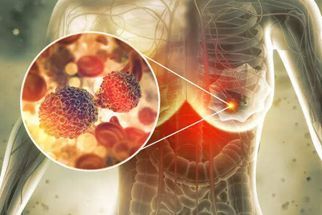 CANCEREVENT's tweet photo. AI Boosts Positive Lymph Node Detection in Breast Cancer 
Read More-https://t.co/1PO5R94JxY 
iCancer Conference -https://t.co/sAZALHqtWF 
#Cancer #Oncology #breastcancerawareness #Conference https://t.co/A1T69rcSdT