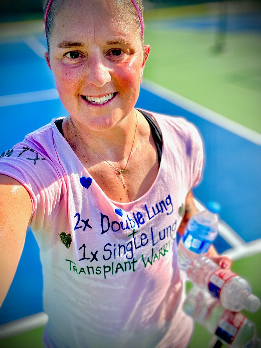 BCM_Surgery (@bcm_surgery) on Twitter photo “I could never be where I am without the village that keeps me alive.” - Rebecca Haskin, a lung transplant patient, recently played tennis in the Transplant Games of America. Read her full story: bit.ly/4d0QQN1 <a href="/GloorLoor/">Gabriel Loor</a> <a href="/GarchaMed/">Puneet Garcha, MD, MBA</a> “I could never be where I am without the village that keeps me alive.” - Rebecca Haskin, a lung transplant patient, recently played tennis in the Transplant Games of America. Read her full story: bit.ly/4d0QQN1 <a href="/GloorLoor/">Gabriel Loor</a> <a href="/GarchaMed/">Puneet Garcha, MD, MBA</a>