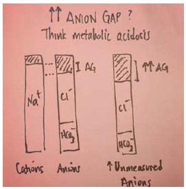 Emergency Medicine News (@emnews) on Twitter photo Do your patient’s blood test results have an elevated anion gap? It’s almost always associated with metabolic acidosis.
<a href="/M_Lin/">Michelle Lin, MD</a> has an easy mnemonic to remember the causes of metabolic acidosis. tinyurl.com/yj82ma22 #FOAMed Do your patient’s blood test results have an elevated anion gap? It’s almost always associated with metabolic acidosis.
<a href="/M_Lin/">Michelle Lin, MD</a> has an easy mnemonic to remember the causes of metabolic acidosis. tinyurl.com/yj82ma22 #FOAMed