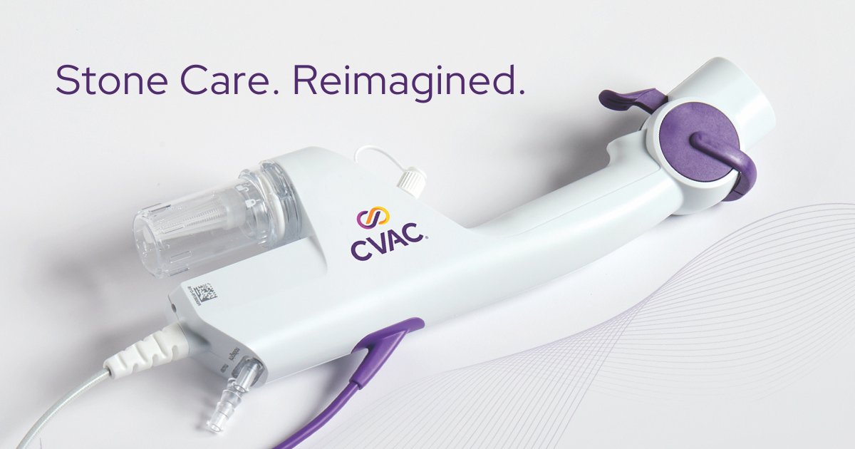 🌟 The SURE (Steerable Ureteroscopic Renal Evacuation) Procedure introduces a paradigm shift in #kidneystone care. It uses #irrigation and vacuum #aspiration to evacuate stone fragments during laser #lithotripsy, enabling clinicians to achieve a stone-free outcome.
Learn about