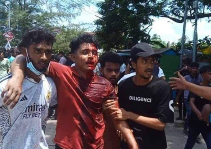 mahfuzbodda's tweet photo. Chhatra League goons, the student wing of ruling Awami League, firing on student protesters with police to the innocent students.

Evidence 66:

@AJEnglish

@UN
#SaveBangladeshiStudents #HumanRightsViolations #StepDownHasina https://t.co/dCZPXlEhJ7