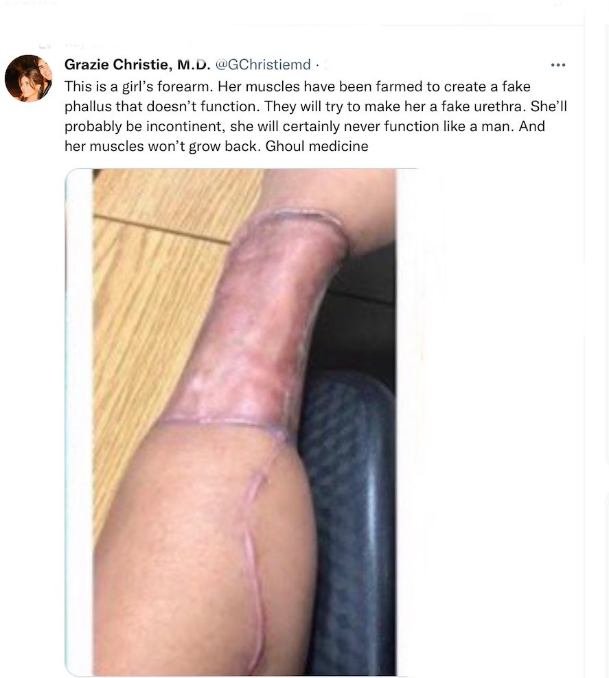 Glinner's tweet photo. Ah, Mike what a heartbreaker. The man who wrote 'Whole of The Moon' is another idiot complicit in  a medical scandal. https://t.co/UTRHmUiBy9