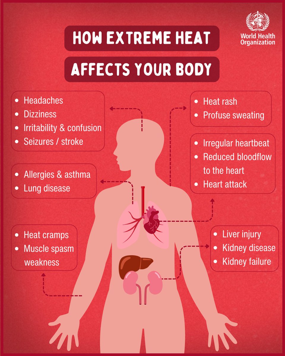 WHO's tweet image. Extreme heat is deadly. Heat stress is the leading cause of weather-related illness and deaths.

We must act now to protect people and our planet.

Read the call to action on extreme heat by @UN SG @antonioguterres:
bit.ly/4bZ307C