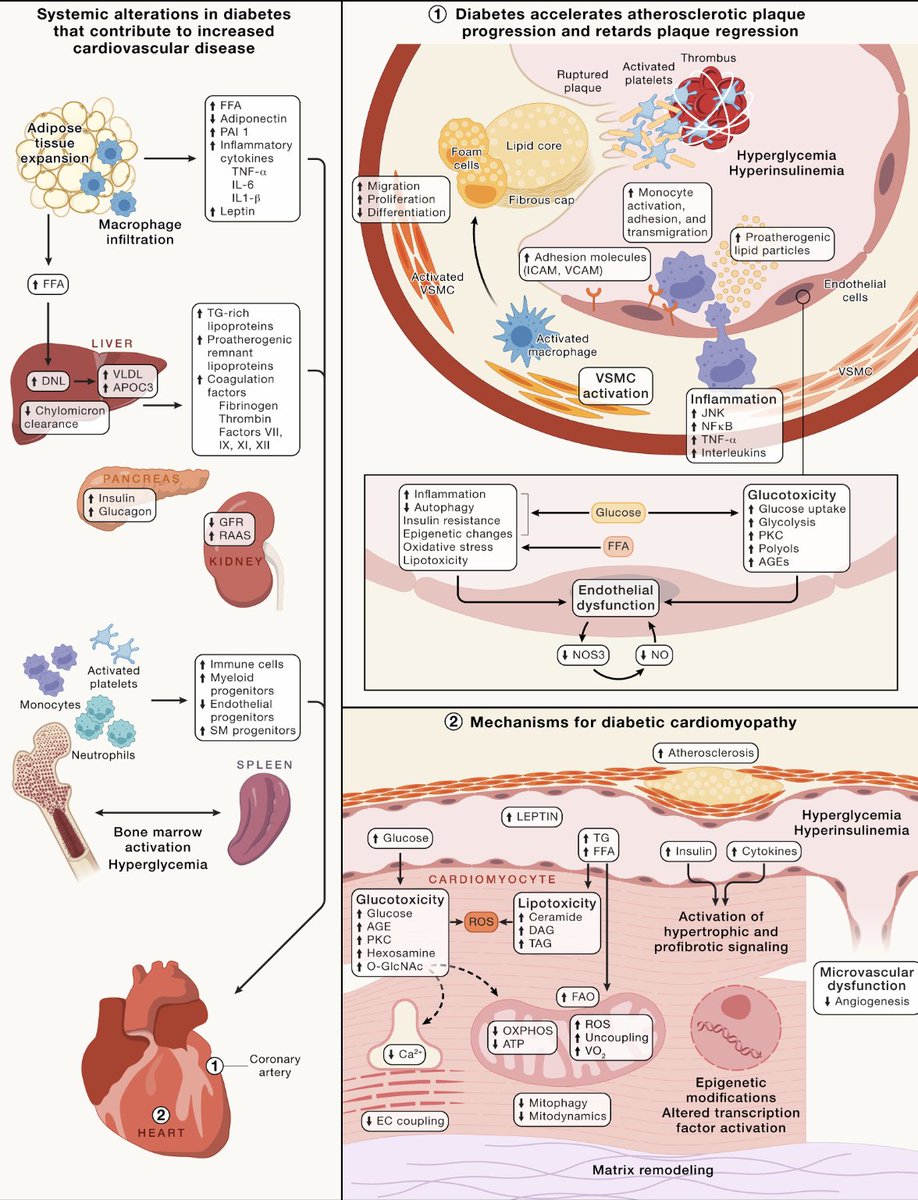 Check out Figure 6, all you need to know about how diabetes causes #CVD. sciencedirect.com/science/articl…