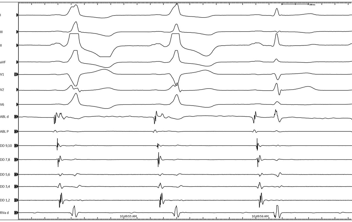Mike Manogue tweet media