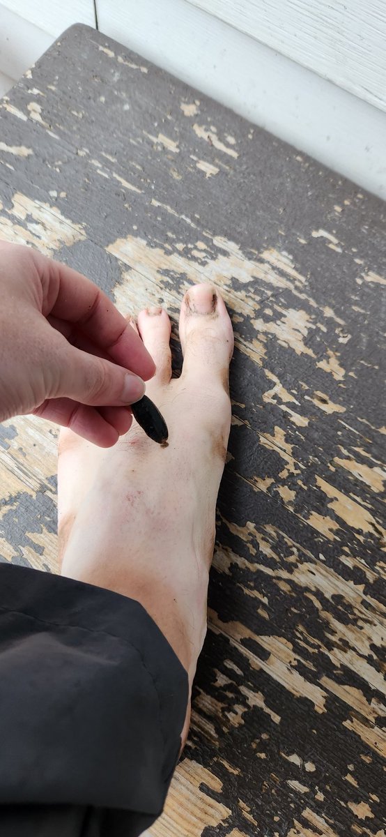 Out of all the animals who have bitten me and drank my blood, I think leeches are my favorite. No itching, no Lyme disease, no nothing. Little dude was on my foot for hours and I didn't notice until I took off my sandal.

So yeah, camping was pretty fun