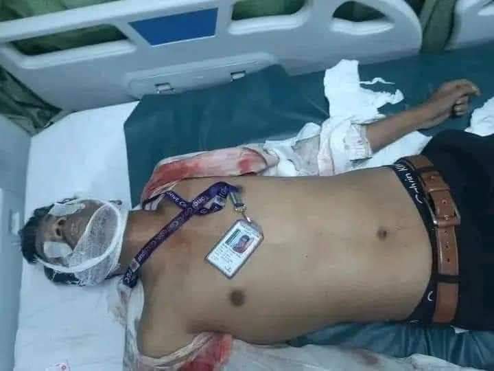 Cule_Asif's tweet photo. Bangladesh Government and their Police Force and Terror openly killed innocent Students because they wanted to remove the quota from the government's Job. So In this Situation, We need Help.
#Bangladesh
#AllEyesonBangladesh
#StepDownHasina
#Weneedfreedom https://t.co/v3eEvKyNfz