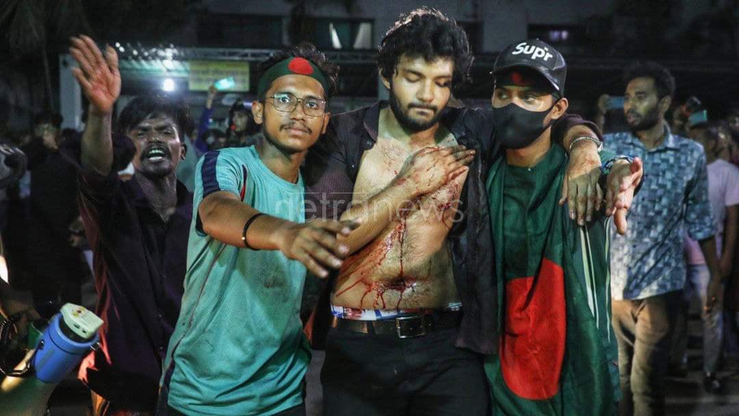 Cule_Asif's tweet photo. Bangladesh Government and their Police Force and Terror openly killed innocent Students because they wanted to remove the quota from the government's Job. So In this Situation, We need Help.
#Bangladesh
#AllEyesonBangladesh
#StepDownHasina
#Weneedfreedom https://t.co/v3eEvKyNfz