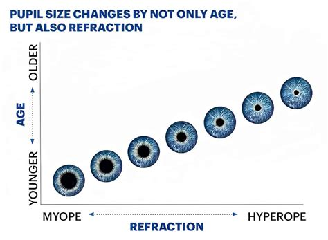 TickTock2023's tweet photo. @nettermike For instance, and on top of that, younger people usually have more dilated pupils. https://t.co/ZafU95fF3a
