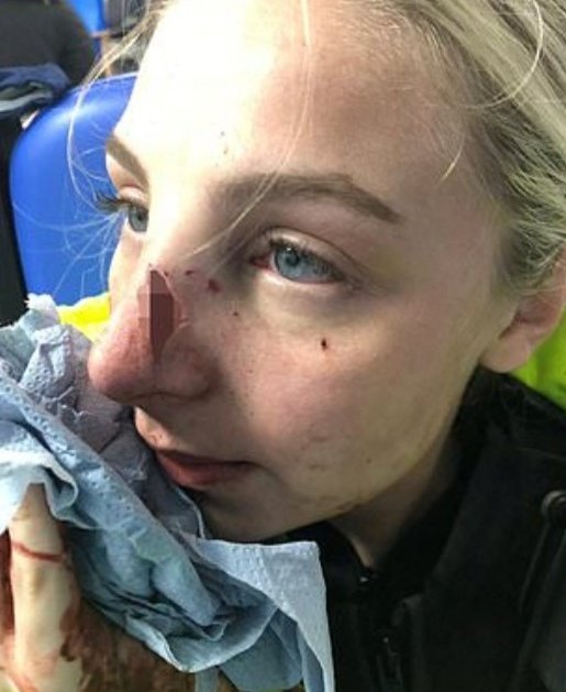 Bushra1Shaikh's tweet image. This image on the left is circulating as the female police officer that was hurt during the Manchester incident.

The right is the truth. From 2020 completely unrelated.

GMP are keeping their evidence close to their chest and now hiding behind being 'investigated'.