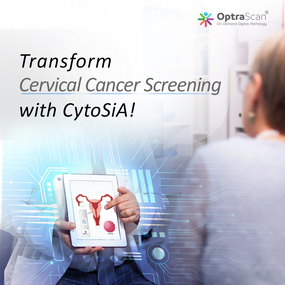 OptraSCAN's tweet photo. #CytoSiA employs cutting-edge technology for simultaneous scanning &amp; automated analysis, reducing turnaround times &amp; enhancing diagnostic precision, advanced liquid-based cytology &amp; conventional pap smear techniques ensuring accurate detection #CervicalCancer #OptraSCAN #Cytology https://t.co/DS9MvjZcar