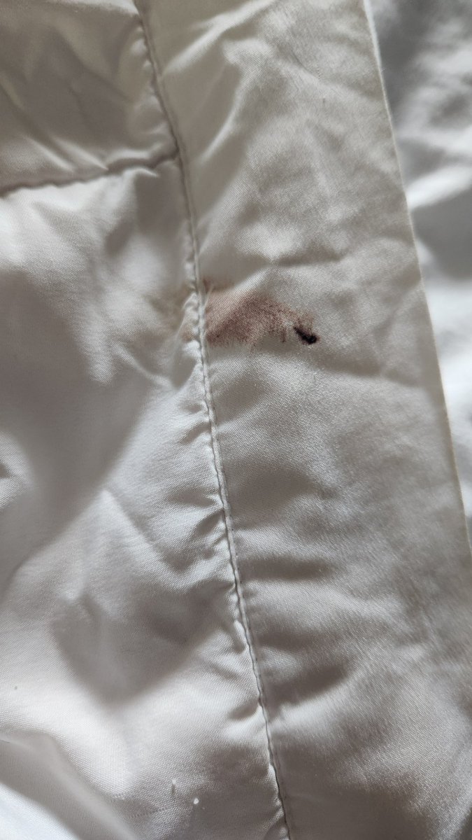 DuragSwag77's tweet photo. I'm more than disgust and unsatisfied with how our hotel room away 7 hours on vacation with blood and stains on bed sheets and covers that my KIDS would have had to sleep in. it is more than unfit for a children or any one to stay in a room under these conditions.@DaysInnDestin https://t.co/pCdiLBMAyg
