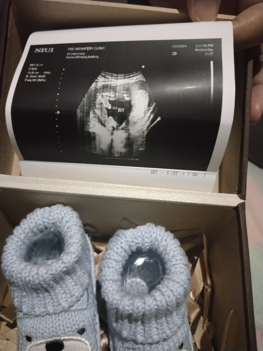 xojmdcm's tweet photo. It's a boyy 🥹🥰 https://t.co/J0FK7OJx26