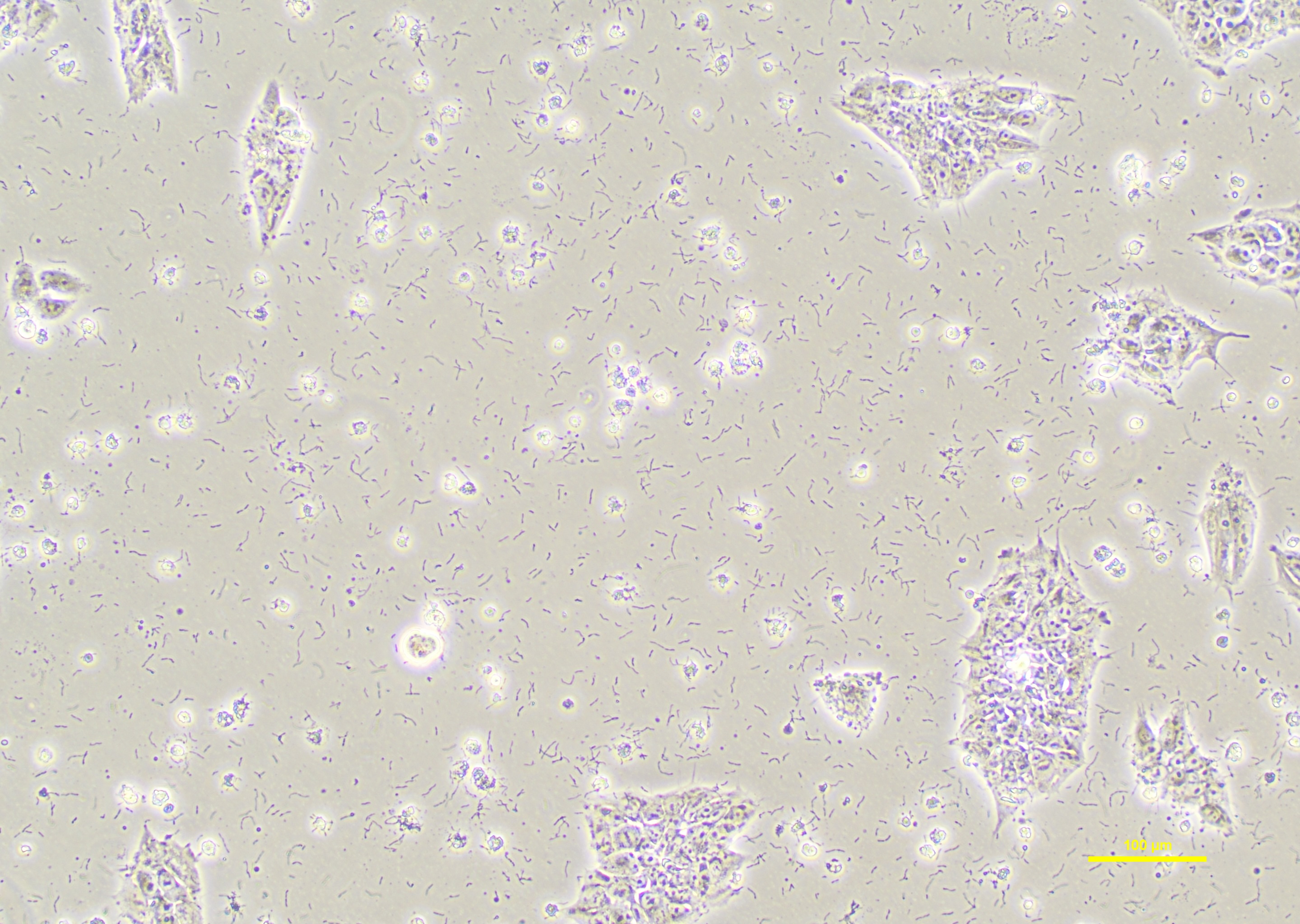 ユ*ノ様 大株出品 vp mix 胞子培養株 ユ*ノ様 大株出品 vp mix 胞子