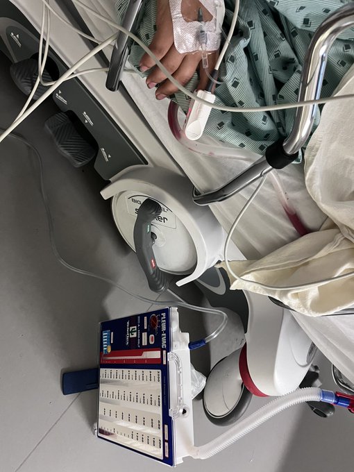 I never post personal family things but my daughter needs prayers! My daughter had a horrific horseback<a href="/tag/horsemanship"class="tags"><span>#horsemanship</span></a>