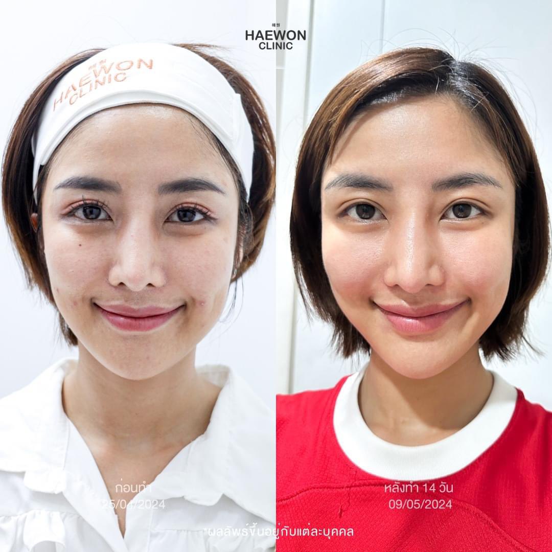 Review_Haewonclinic tweet media