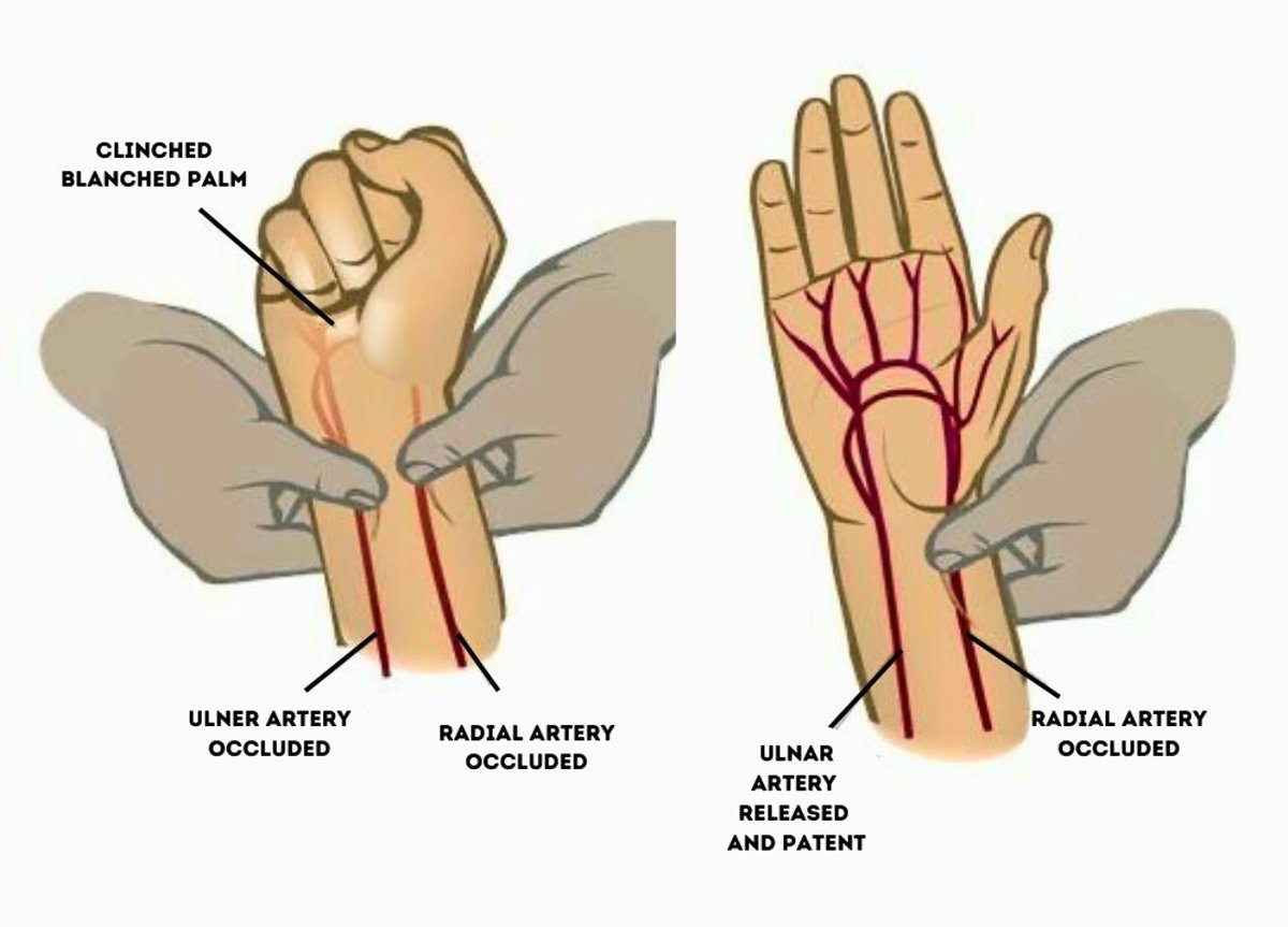 Dr.Zaki A. Alzaher د.زكي بن عبدالله الزاهر tweet media