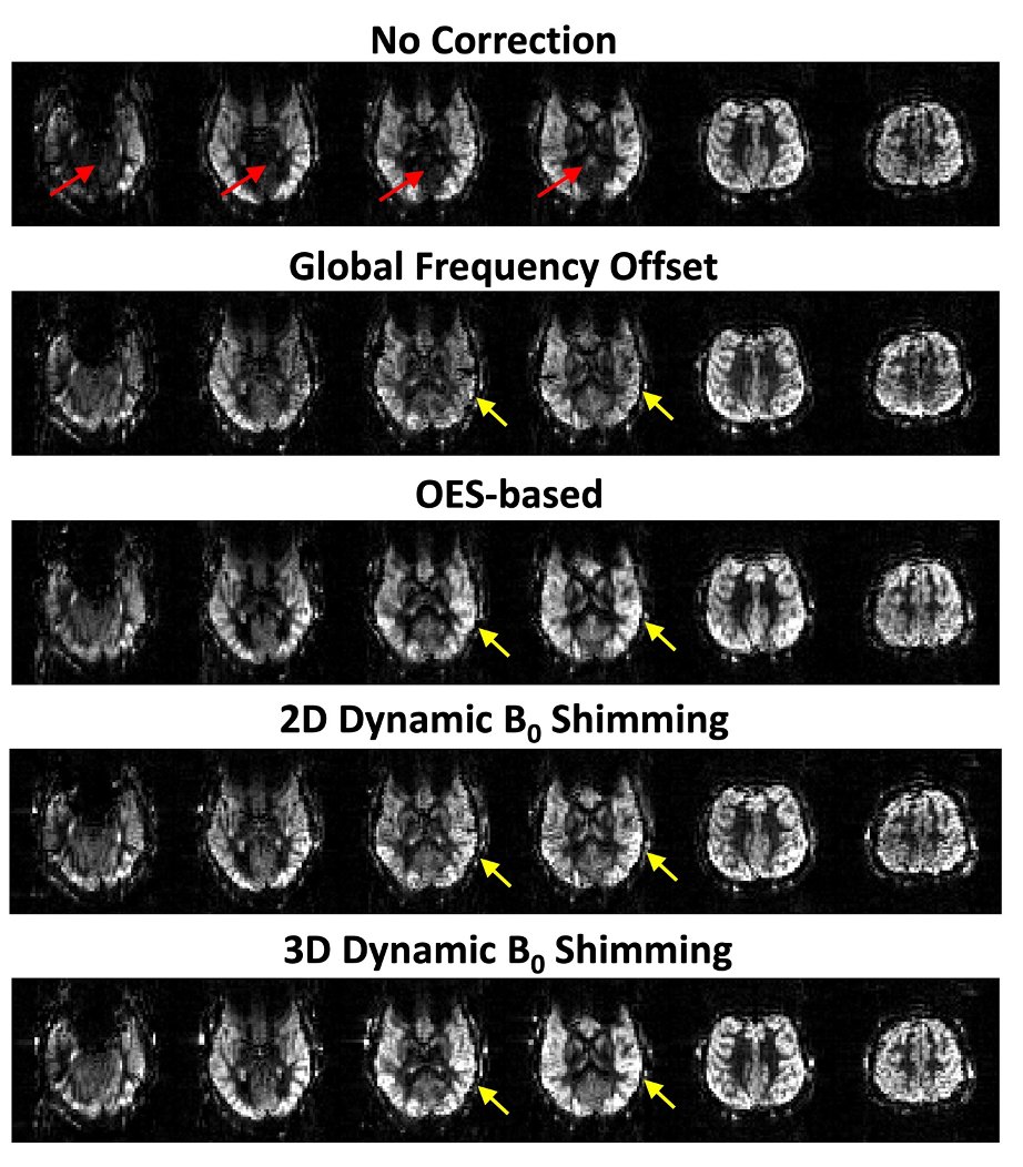 New preprint: our efforts towards a simple and highly effective correction of off-resonance in pseudo-continuous arterial spin labeling, which is a major issue at 7T! 1/2