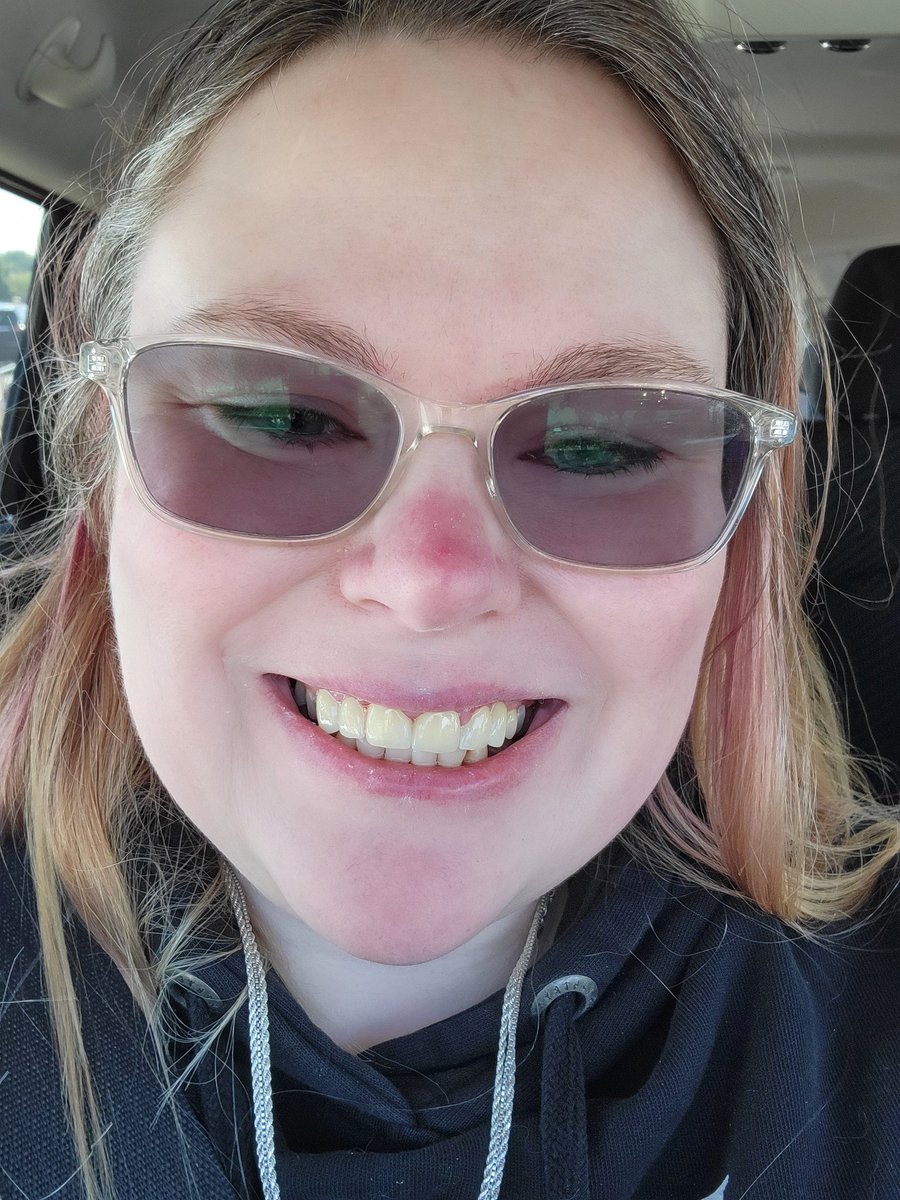 Permanent crowns are in!