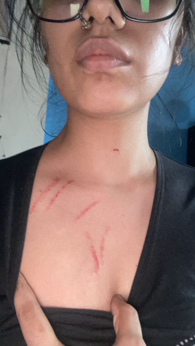 abhijeetkumarof's tweet photo. Serious assault on Major Saras Tripathi and his daughter (causing injury on face, neck and chest to the daughter) resident of Antriksh Green Apartment, Kaushambi, Ghaziabad by Sangeeta Srivastava, Manish Srivastava. @ghaziabadpolice @myogiadityanath

1/4 https://t.co/8NdzVcVNyU