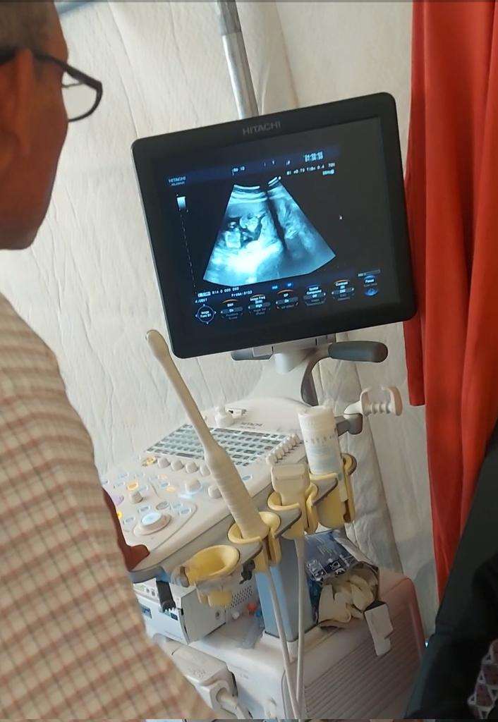 My wife and I had a pregnancy check-up in a tent. as you can see, The doctor confirmed she is pregnant with twins but informed us that most of the necessary medications and tests are unavailable. Plz support us so we can have our children in a safe place
gofund.me/30492ae7