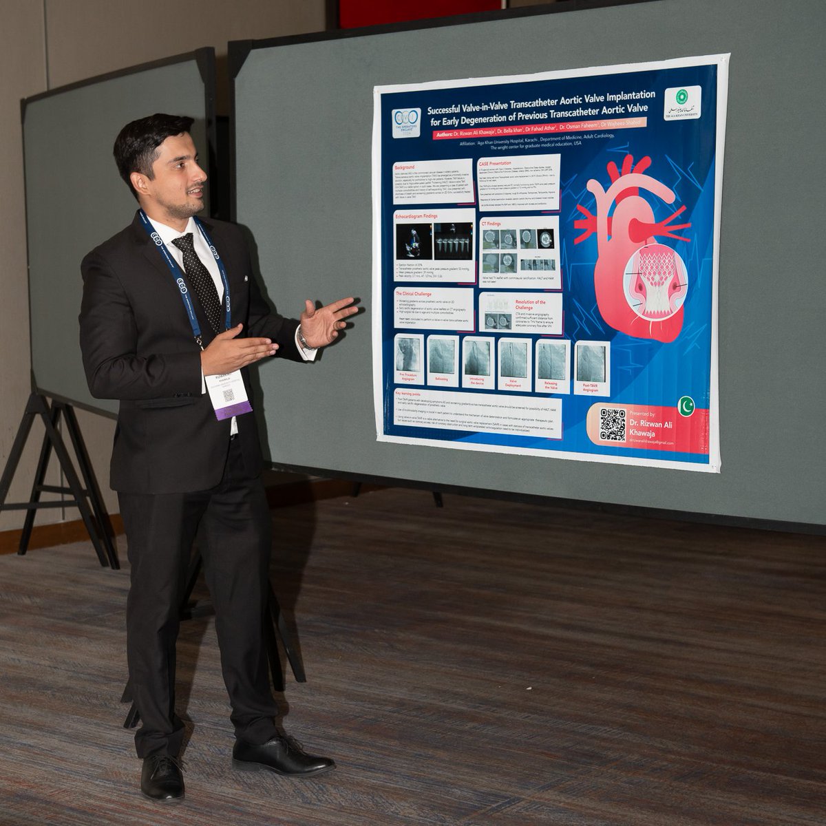 Im_dr_khawaja's tweet photo. Thrilled to present my abstract at #CVI2024! Honored to represent #AKUglobal and #Pakistan's contributions to the field. Exciting times ahead! 🇵🇰 #Cardiology #Innovation @osmanfaheem1 @cvinnovations  #Valveinvalve #Colorado @AKUGlobal https://t.co/sFrsl4RelV