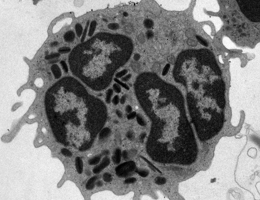 Short-lived Ly6G+ #macrophages help repair lung damage after #flu infections in mice.

Learn more in Science #Immunology: scim.ag/7TC