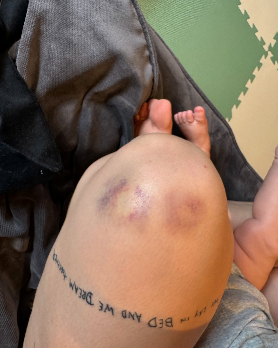 ANNE-MARIE tweet media