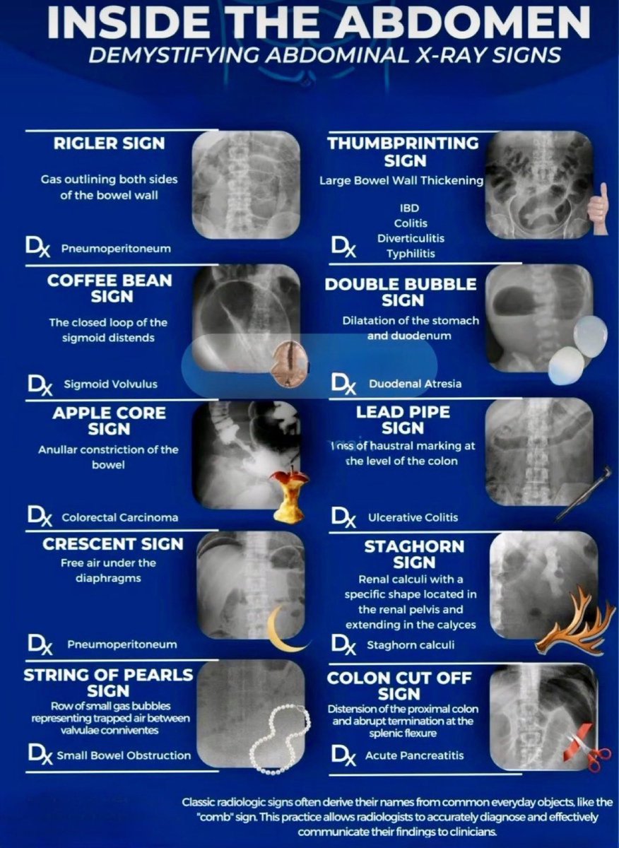imedverse's tweet photo. Abdominal X-ray #MedEd #MedX https://t.co/nGTDWNlyuK