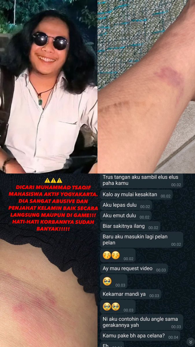 mallaschenee's tweet photo. ⚠️‼️UNTUK ORANG JOGJAKARTA DAN SEKITARNYA⚠️‼️

‼️HATI-HATI DENGAN ORANG INI, INGETIN MUKA PSIKOPATNYAA, JANGAN KASIH LOLOS‼️

INI NIH PELAKU ABUSIVE TINGKAT PSIKOPAT, MANIPULATIF, NPD, PLAYING VICTIM, GASHLIGHTING, PENGECUT, PENJAHAT KELAMIN. KELUAR LO TSAQIF!!! https://t.co/hfb5btbA2j