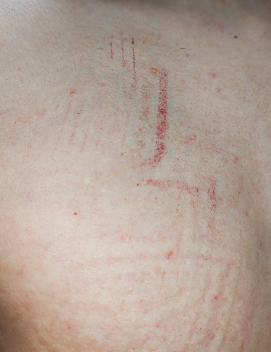 dm_suby's tweet image. 家人们谁懂啊，能留个完整的鞋印得有多幸福👟😆

#男m #女s #踩踏 #恋足 #踩射 #鞋底 #上海 #调教 #现实 #女王 #踢裆 #乘骑 #舔鞋 #狗奴 #鞋印