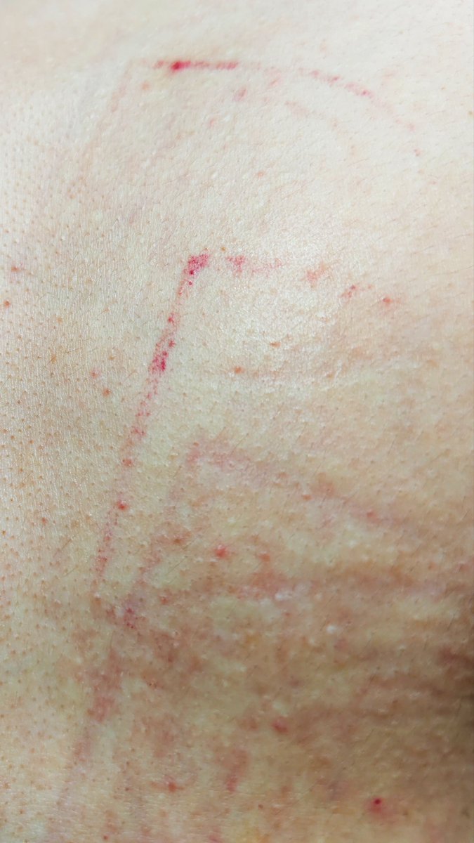 dm_suby's tweet image. 家人们谁懂啊，能留个完整的鞋印得有多幸福👟😆

#男m #女s #踩踏 #恋足 #踩射 #鞋底 #上海 #调教 #现实 #女王 #踢裆 #乘骑 #舔鞋 #狗奴 #鞋印