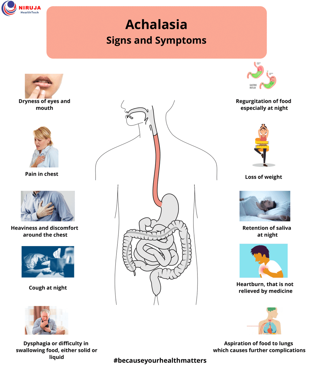 AB_drmd's tweet photo. ما هي اعراض هذه الحالة؟
- عسر البلع/Dysphagia لكل من المواد الصلبة و السائلة، غالباً ما تحدث على مدى أشهر إلى سنوات.
- ارتجاع الطعام غير المهضوم و اللعاب، خاصة في الليل.
- ألم الصد يشبه الم القلب.
- فقدان الوزن: نتيجة لصعوبة البلع و تناول الطعام.
- رائحة الفم الكريهة: بسبب ركود الطعام و النمو البكتيري.