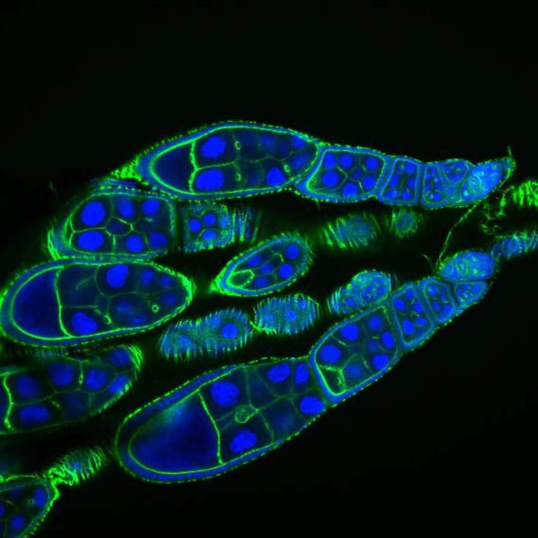 ChanZuckerberg's tweet photo. Just like a city planner uses satellite imagery, @ZitaCarvalhoSa1 @BEmicroFAB + @HenriquesLab use advanced microscopy to map cellular processes in high detail https://t.co/ymVvsEINwT