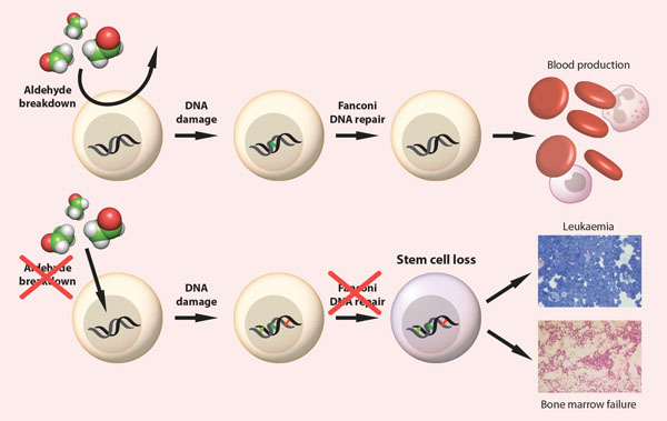 renesugar's tweet photo. Alcohol by-product destroys blood stem cells #acetaldehyde #ALDH2 #MECFS #LongCovid
https://t.co/3dD2d8S4uj https://t.co/OTdJaqt9oa