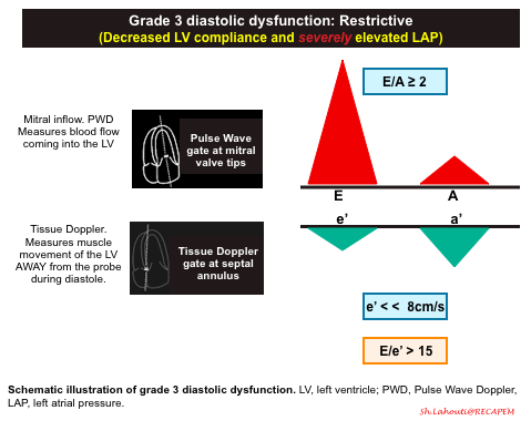 ZHeart11768530's tweet photo. 🔴A Practical Approach To Diagnosis of #HFpEF #Diastology
⤵️
🔹https://t.co/jOTaKkgJB5
 #FOAMed #MedEd #medstudent #paramedic #Cardiology #CardioEd #medtwitter #meded #CardioTwitter #cardiotwiteros  #MedX #cardiovascular #MedTwitter #medical #medEd #cardiotwitter #medicine https://t.co/q6Qcm997fA