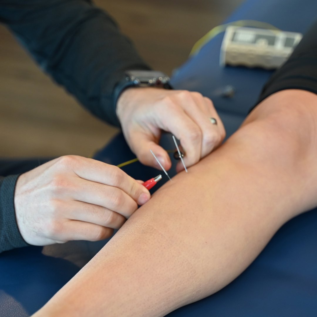 ISS_Seminars's tweet photo. Healthcare pros: Join our Integrated Needling Seminar in Calgary! Learn advanced #needling for pain management and #neuromodulation.

👉 Techniques for upper/lower limbs, head/spine
👉 Acupuncture for neuromodulation
👉 Clean needle protocols

https://t.co/JC9Bci2MMh https://t.co/ILsA3r3sOx