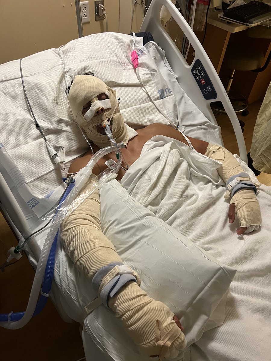 First day back after a fire disaster last Friday. Couldn’t be more blessed definitely had the man above looking over me, thank you to all my friends and family for the prayers. Back to football! #35days #godisgood <a href="/JacksonHS_FB/">Coach Nesbitt</a>