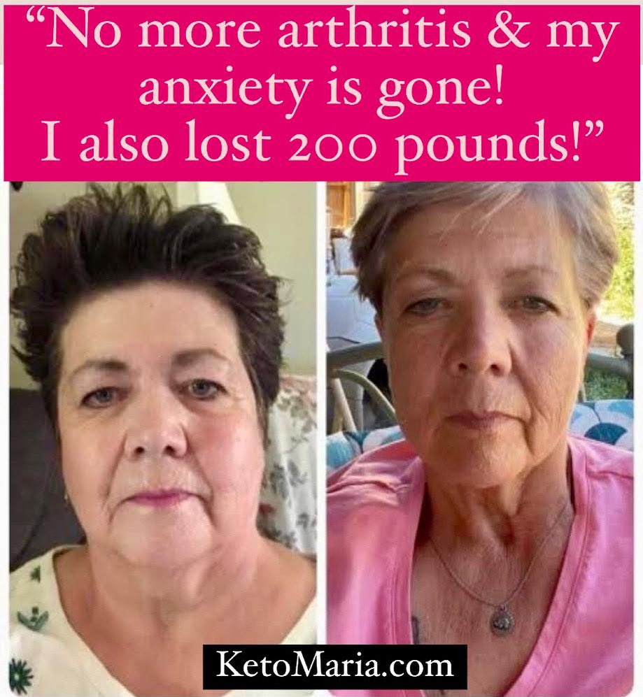 MariaEmmerich's tweet photo. “Thank you so much for your help @MariaEmmerich ! Thank you for your kindness and willingness to share your knowledge. Thank you for my life of enjoying healthy eating!

Ps: I’ve gone from a size plus 24 to a size 4. Loving my life” - Cora

#facetofacefriday #200lbsdown https://t.co/wTC8l1PU38
