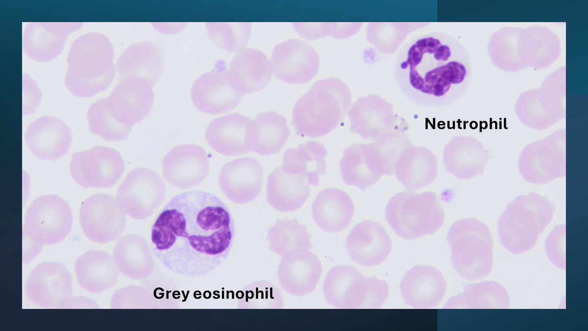 Grey houndに多いですが、他の犬種でも時々見ます