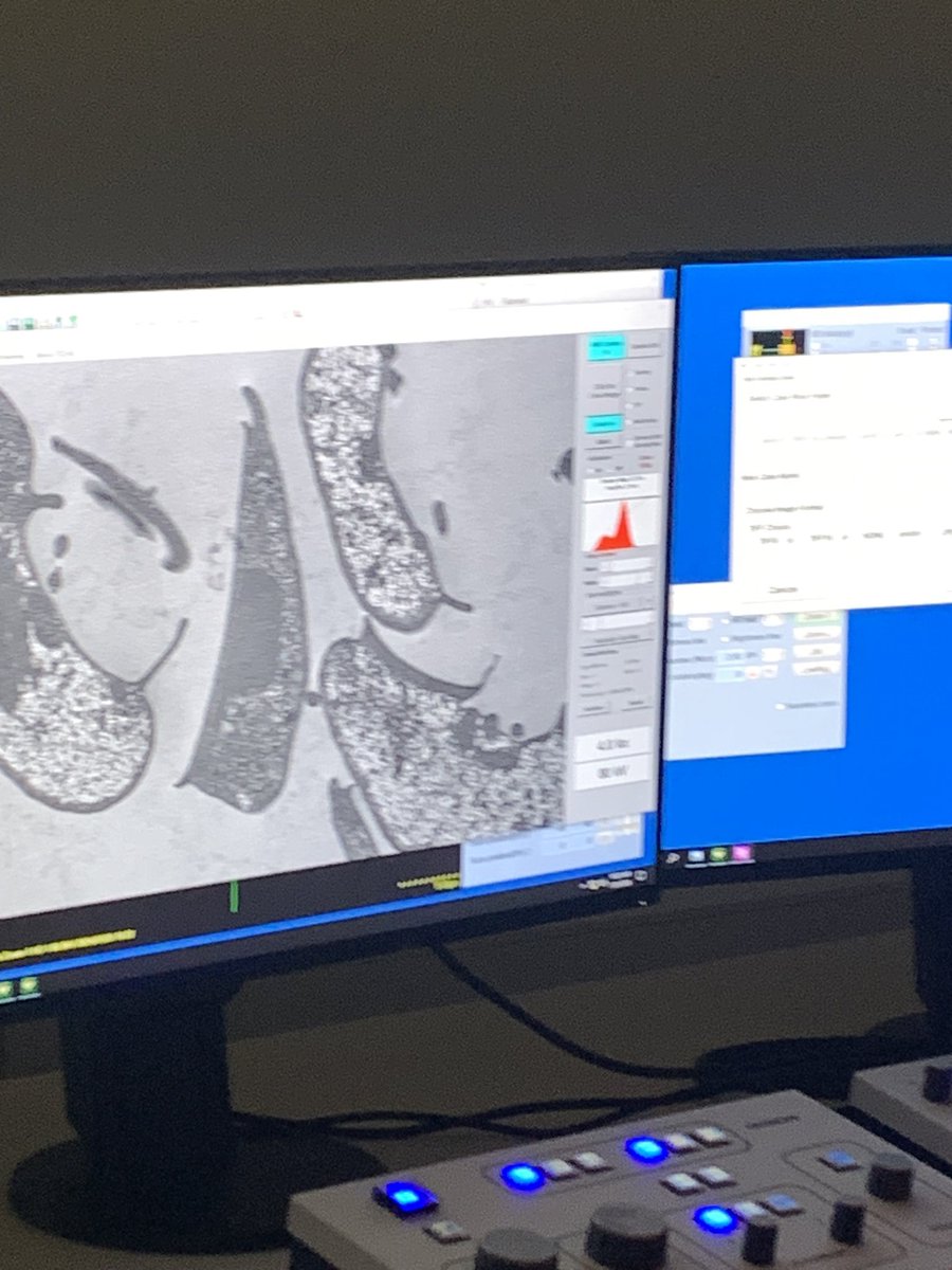 LabMIFerre's tweet photo. Semana de Microscopia Electronica 🔬@maria_touz @CoFeliziani @InstFerreyra @inicsa https://t.co/Io925QHCxI