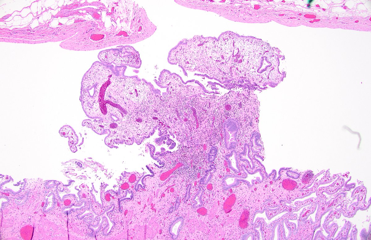 Diane Brackett, MD tweet media