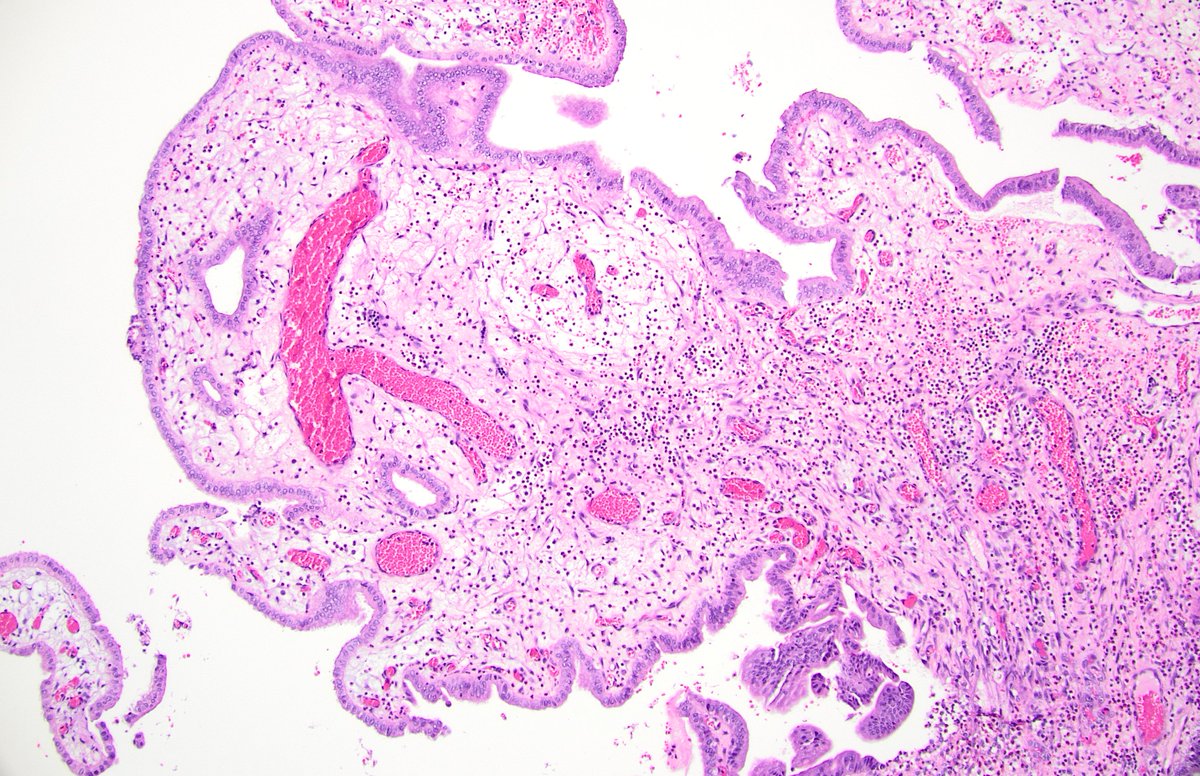 Diane Brackett, MD tweet media