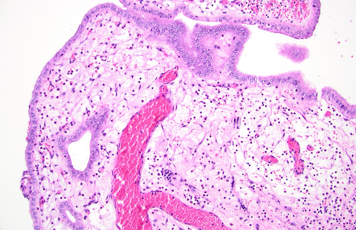 Diane Brackett, MD tweet media